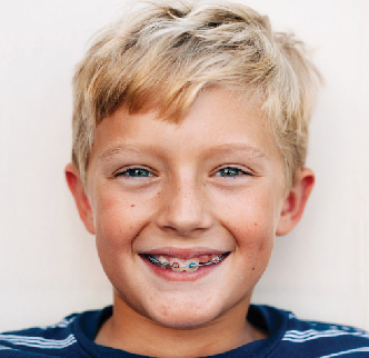 Image of a young boy with braces